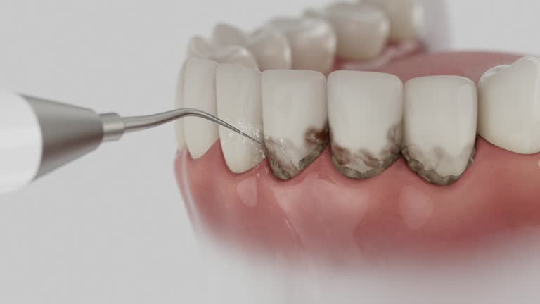 Reliable Dental contractor in Shepherd, MI by Smile Center Dentistry